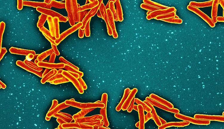 Study Finds Three New Safe, Effective Ways To Treat Drug-Resistant